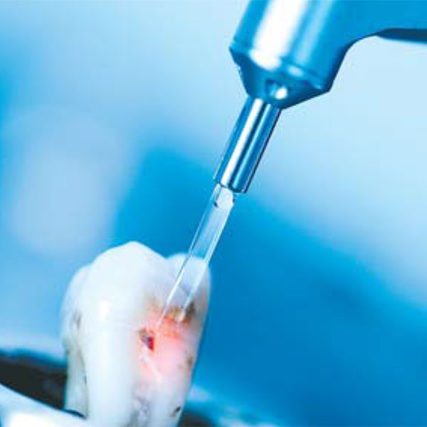 bohren ohne bohrer Laserzahnheilkunde Parodontologie
